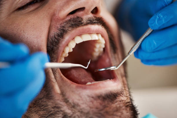 Best Root Canal Emergency Dentist  in Denison, IA